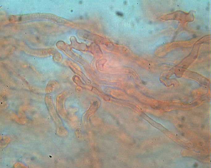 Phlebia rufa